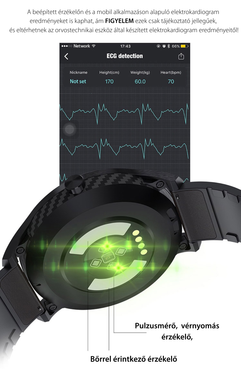 Okosóra Twinkler TKY-SW10 Pulzusmérő funkció, Vérnyomásmérő funkcióval, EKG, Híváselőzmények, Naptár, Bluetooth-szos hívás, Fém szij, Fekete
