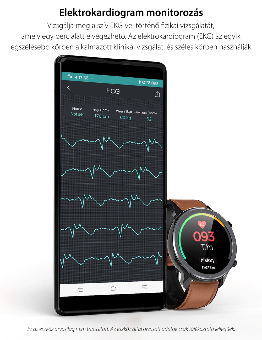 Okosóra Twinkler TKY-L11, Pulzusmérő, Lépésszámláló, Alvásminőség-figyelés, EKG, Hívások és üzenet értesítések, Barna